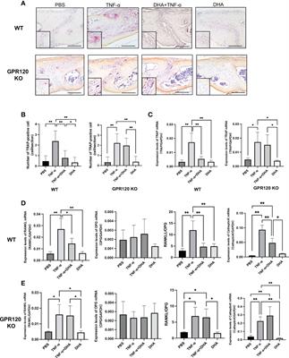 Docosahexaenoic acid inhibits TNF-α-induced osteoclast formation and orthodontic tooth movement through GPR120